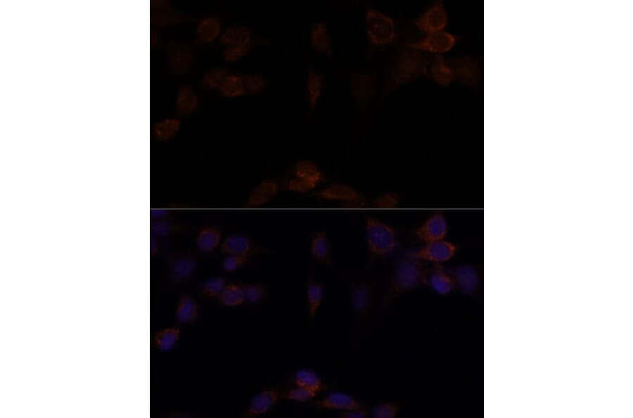 Immunofluorescence - Anti-YAP1 Antibody (A11213) - Antibodies.com