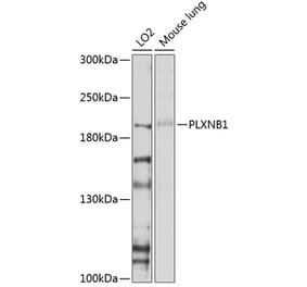 Western Blot - Anti-Plexin B1 Antibody (A11214) - Antibodies.com