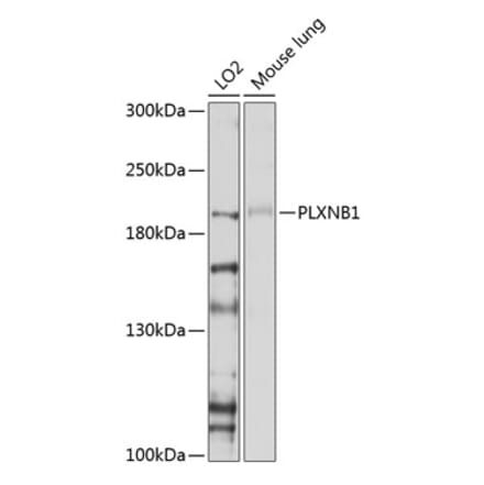 Western Blot - Anti-Plexin B1 Antibody (A11214) - Antibodies.com