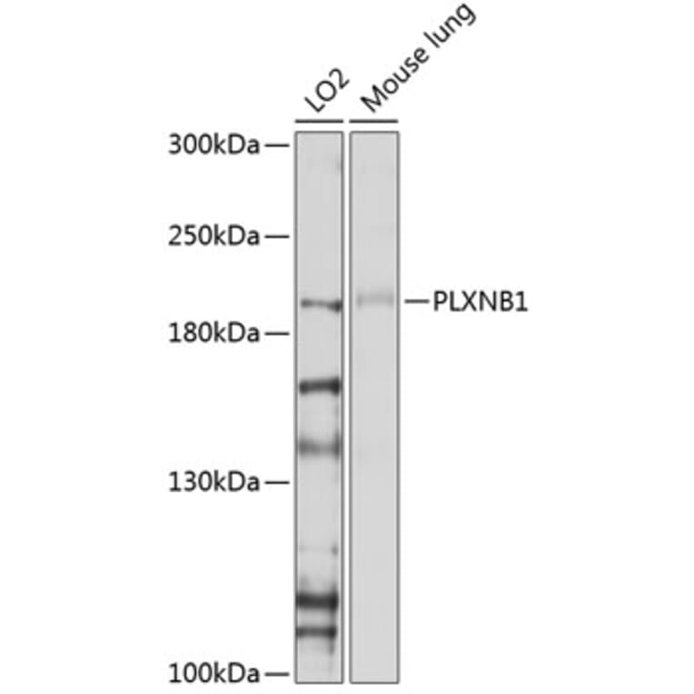 Western Blot - Anti-Plexin B1 Antibody (A11214) - Antibodies.com