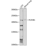 Western Blot - Anti-Plexin B1 Antibody (A11214) - Antibodies.com