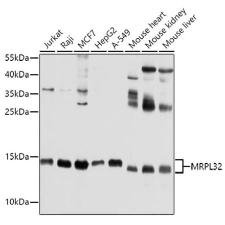 Western Blot - Anti-MRPL32 Antibody (A11215) - Antibodies.com