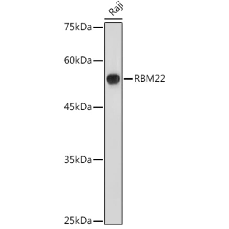 Western Blot - Anti-RBM22 Antibody (A11217) - Antibodies.com