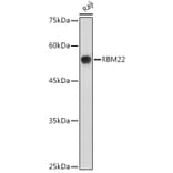 Western Blot - Anti-RBM22 Antibody (A11217) - Antibodies.com