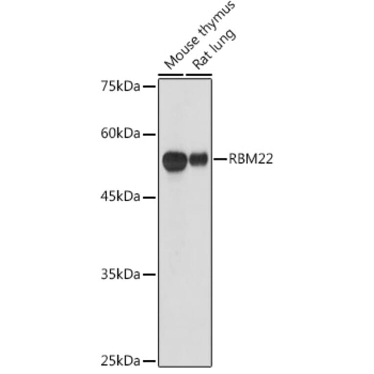 Western Blot - Anti-RBM22 Antibody (A11217) - Antibodies.com