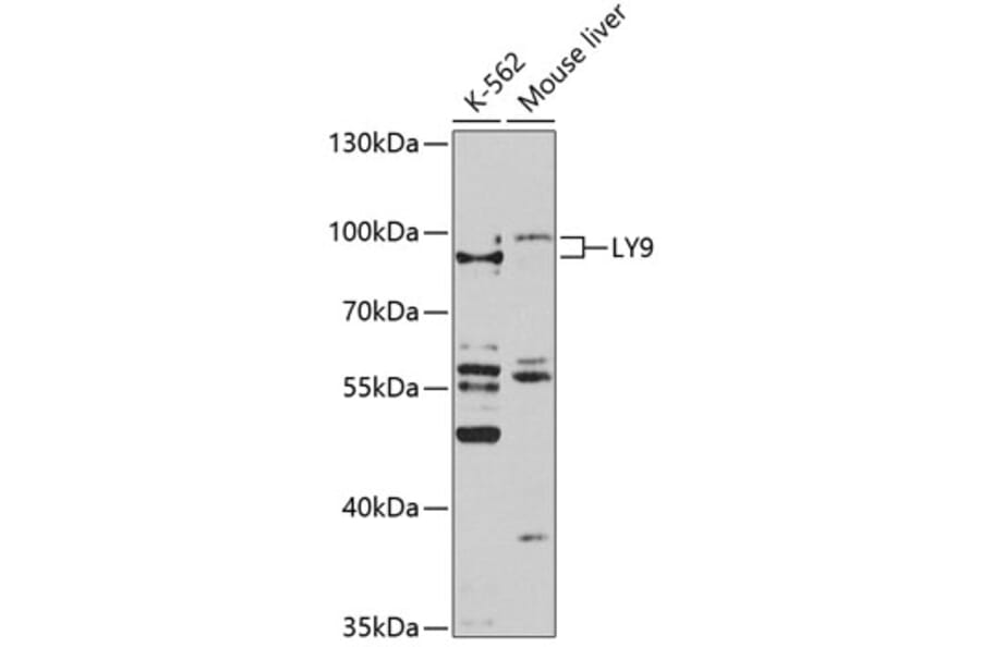 Western Blot - Anti-LY9 Antibody (A10032) - Antibodies.com
