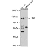 Western Blot - Anti-LY9 Antibody (A10032) - Antibodies.com