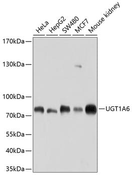 Western blot analysis of extracts of various cell lines, using µgT1A6 antibody (A10033) at 1:1,000 dilution.
Secondary antibody: Goat Anti-Rabbit IgG (H+L) (HRP) (AS014) at 1:10,000 dilution.
Lysates / proteins: 25µg per lane.
Blocking buffer: 3% non-fat dry milk in TBST.
Detection: ECL Basic Kit (RM00020).
Exposure time: 60s.