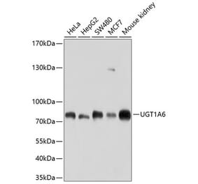 Western Blot - Anti-UGT1A6 Antibody (A11219) - Antibodies.com