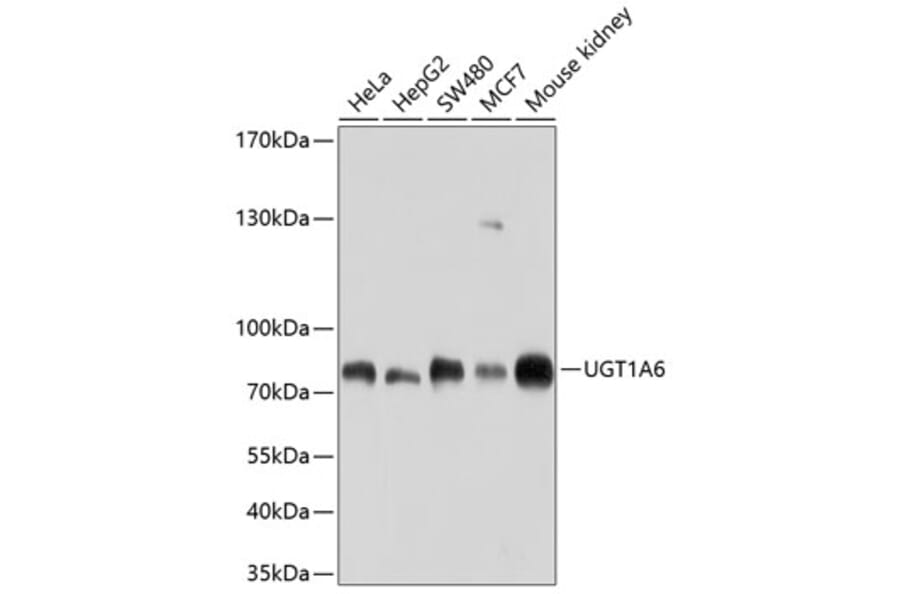 Western Blot - Anti-UGT1A6 Antibody (A11219) - Antibodies.com
