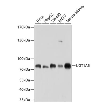 Western Blot - Anti-UGT1A6 Antibody (A11219) - Antibodies.com