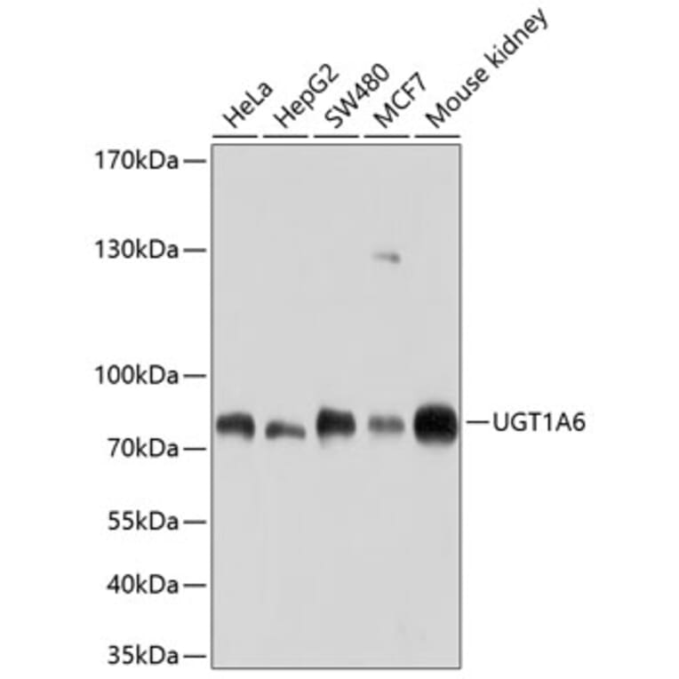 Western Blot - Anti-UGT1A6 Antibody (A11219) - Antibodies.com