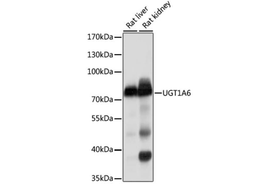 Western Blot - Anti-UGT1A6 Antibody (A11219) - Antibodies.com