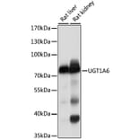 Western Blot - Anti-UGT1A6 Antibody (A11219) - Antibodies.com