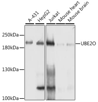 Western blot analysis of extracts of various cell lines, using Anti-UBE2O Antibody (A10036) at 1:1,000 dilution.
Secondary antibody: Goat Anti-Rabbit IgG (H+L) (HRP) (AS014) at 1:10,000 dilution.
Lysates / proteins: 25µg per lane.
Blocking buffer: 3% non-fat dry milk in TBST.
Detection: ECL Basic Kit (RM00020).
Exposure time: 1s.