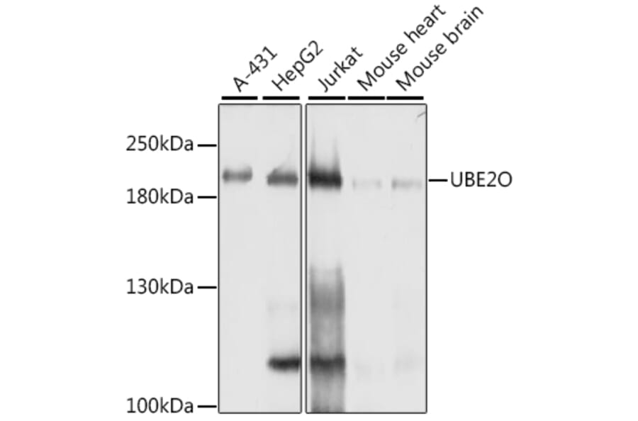 Western Blot - Anti-UBE2O Antibody (A11220) - Antibodies.com