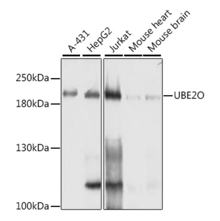 Western Blot - Anti-UBE2O Antibody (A11220) - Antibodies.com