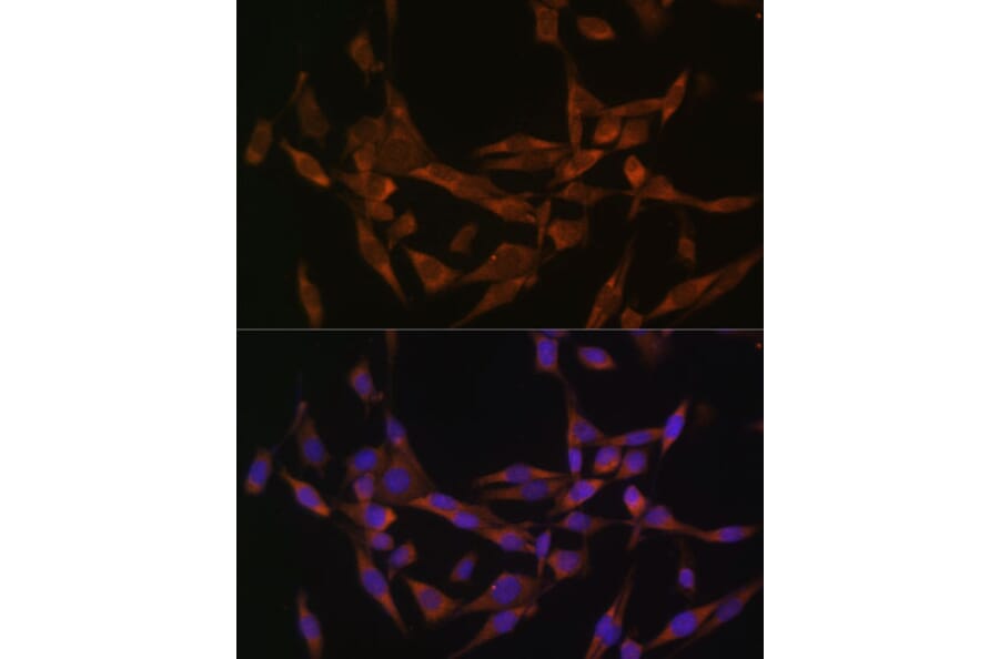 Immunofluorescence - Anti-UBE2O Antibody (A11220) - Antibodies.com