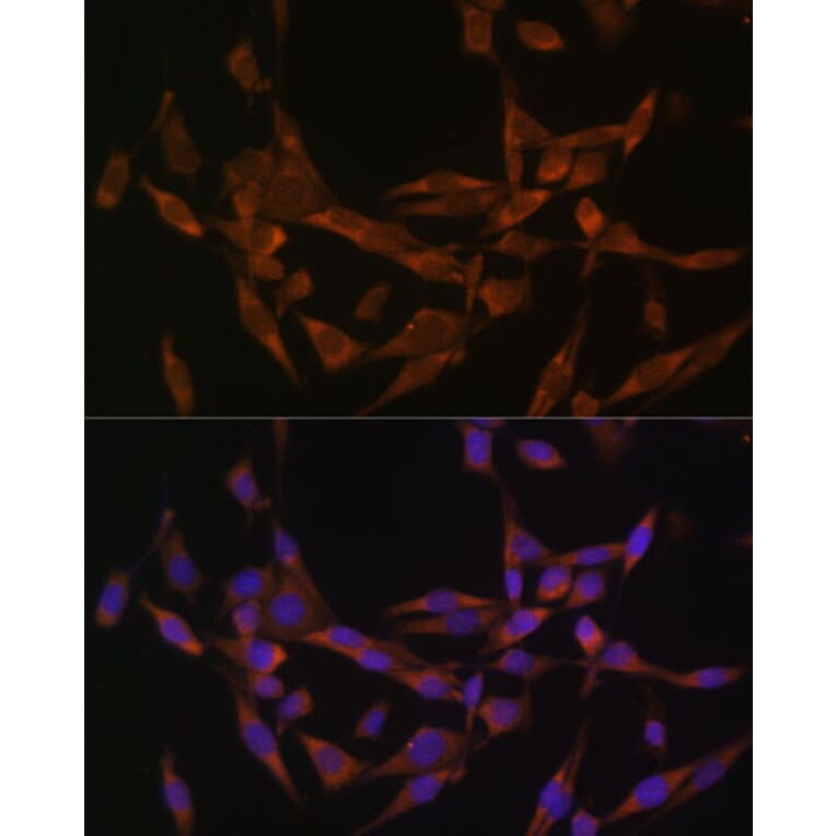 Immunofluorescence - Anti-UBE2O Antibody (A11220) - Antibodies.com