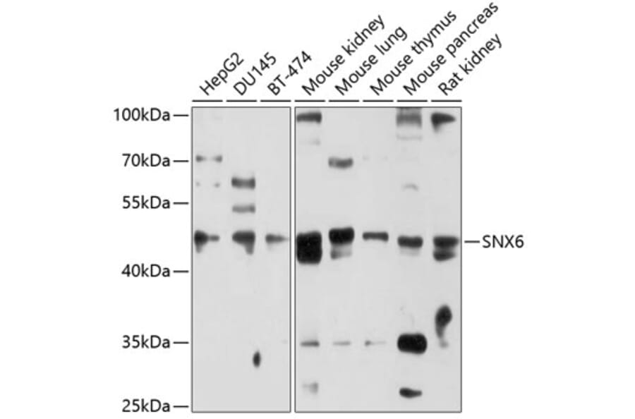 Western Blot - Anti-SNX6 Antibody (A10039) - Antibodies.com