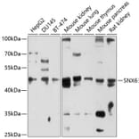 Western Blot - Anti-SNX6 Antibody (A10039) - Antibodies.com