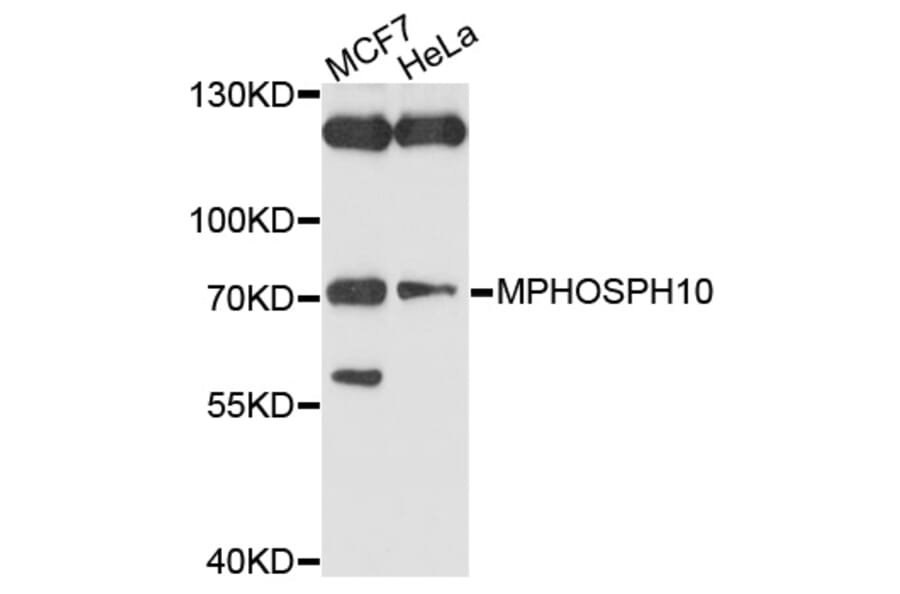 Western Blot - Anti-MPHOSPH10 Antibody (A10041) - Antibodies.com