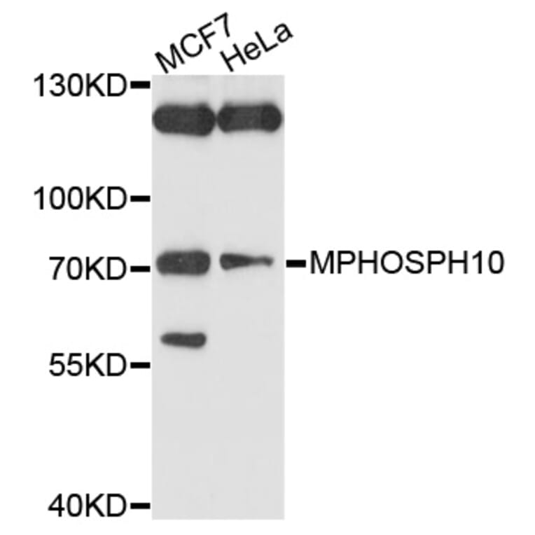 Western Blot - Anti-MPHOSPH10 Antibody (A10041) - Antibodies.com