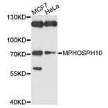 Western Blot - Anti-MPHOSPH10 Antibody (A10041) - Antibodies.com