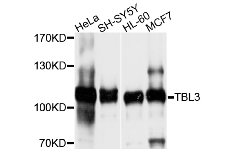 Western Blot - Anti-TBL3 Antibody (A10043) - Antibodies.com