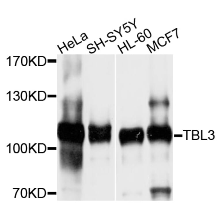 Western Blot - Anti-TBL3 Antibody (A10043) - Antibodies.com