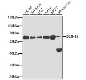 Western Blot - Anti-ZC3H15 Antibody (A11225) - Antibodies.com