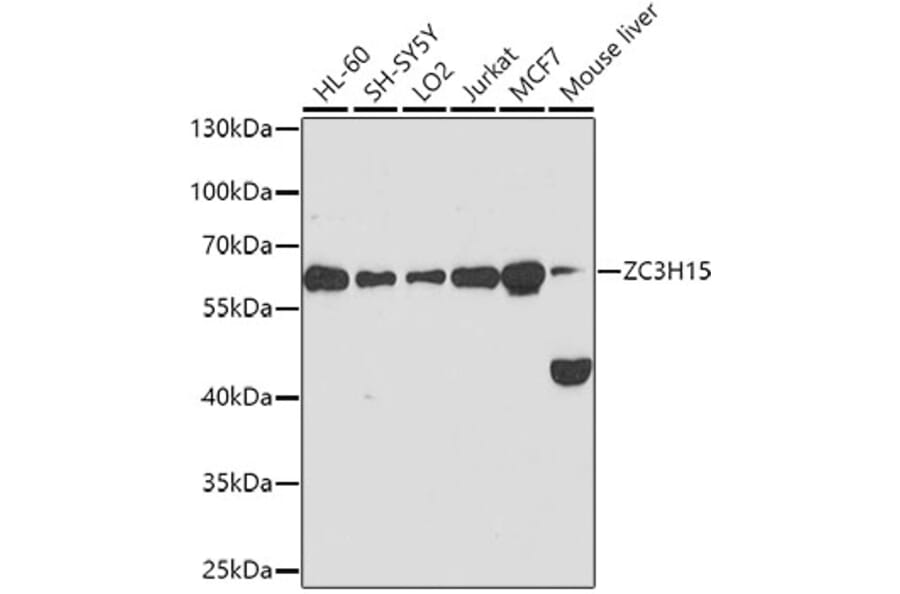 Western Blot - Anti-ZC3H15 Antibody (A10045) - Antibodies.com
