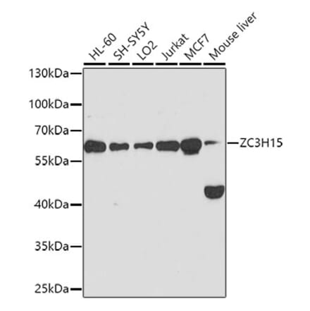 Western Blot - Anti-ZC3H15 Antibody (A11225) - Antibodies.com