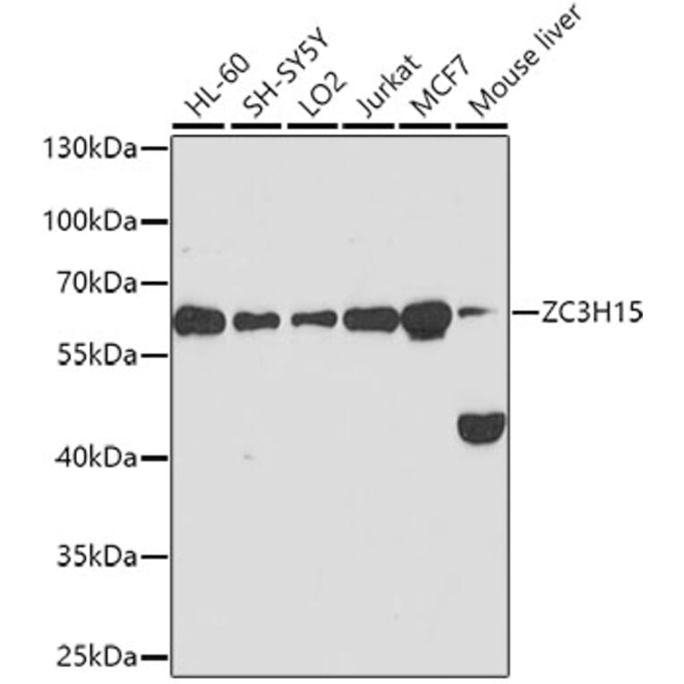 Western Blot - Anti-ZC3H15 Antibody (A10045) - Antibodies.com