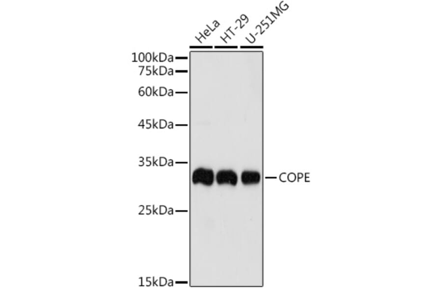 Western Blot - Anti-COPE Antibody (A11226) - Antibodies.com