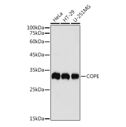 Western Blot - Anti-COPE Antibody (A11226) - Antibodies.com
