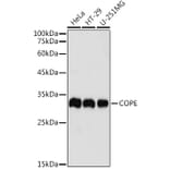 Western Blot - Anti-COPE Antibody (A11226) - Antibodies.com