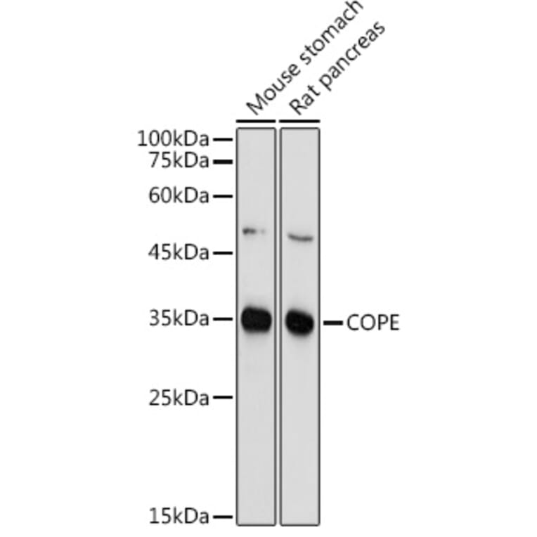 Western Blot - Anti-COPE Antibody (A11226) - Antibodies.com