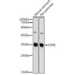 Western Blot - Anti-COPE Antibody (A11226) - Antibodies.com