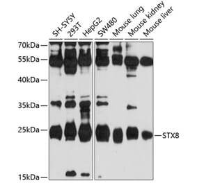 Western Blot - Anti-Syntaxin 8 Antibody (A11228) - Antibodies.com