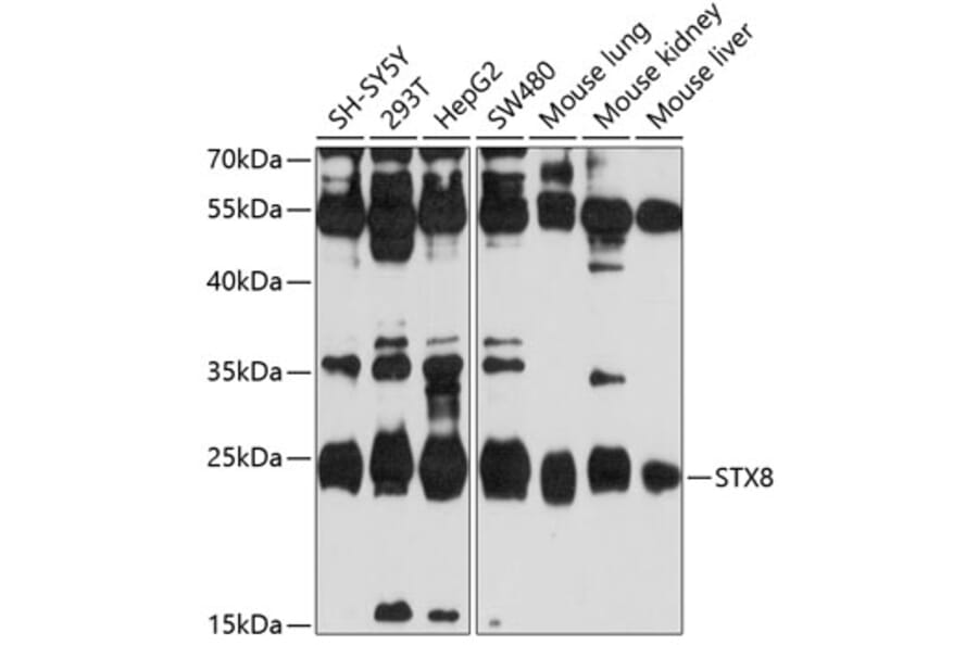 Western Blot - Anti-Syntaxin 8 Antibody (A11228) - Antibodies.com