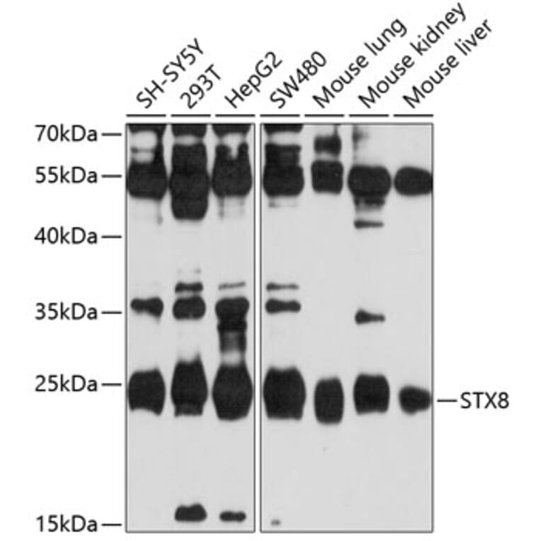 Western Blot - Anti-Syntaxin 8 Antibody (A11228) - Antibodies.com