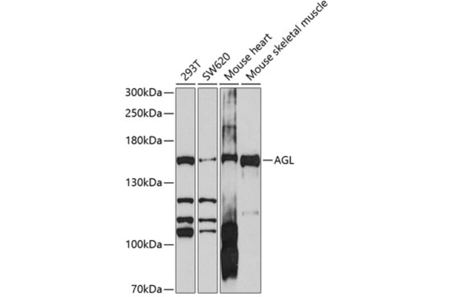 Western Blot - Anti-AGL/Alpha-glucosidase Antibody (A11229) - Antibodies.com