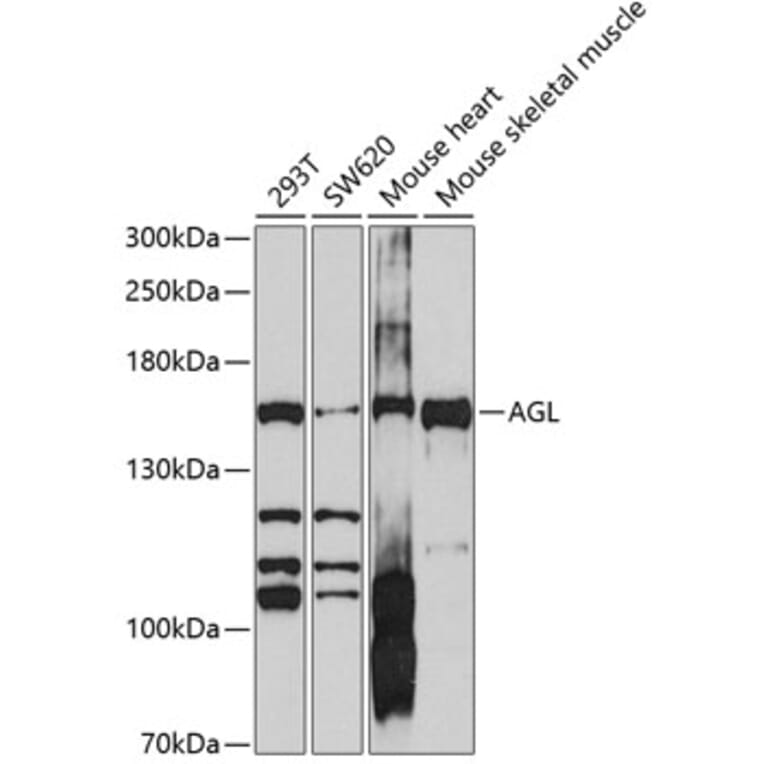 Western Blot - Anti-AGL/Alpha-glucosidase Antibody (A11229) - Antibodies.com