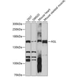 Western Blot - Anti-AGL/Alpha-glucosidase Antibody (A11229) - Antibodies.com