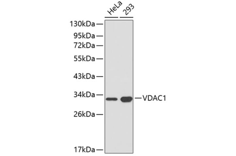 Western Blot - Anti-VDAC1 Antibody (A1006) - Antibodies.com