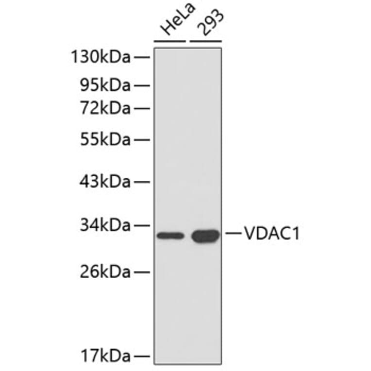 Western Blot - Anti-VDAC1 Antibody (A1006) - Antibodies.com