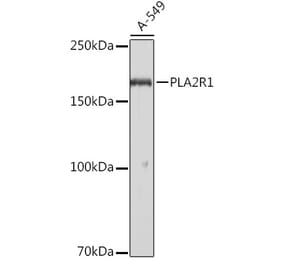 Western Blot - Anti-PLA2R Antibody (A11232) - Antibodies.com