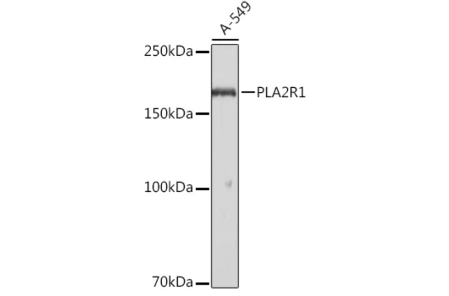 Western Blot - Anti-PLA2R Antibody (A11232) - Antibodies.com