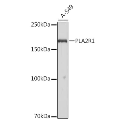 Western Blot - Anti-PLA2R Antibody (A11232) - Antibodies.com